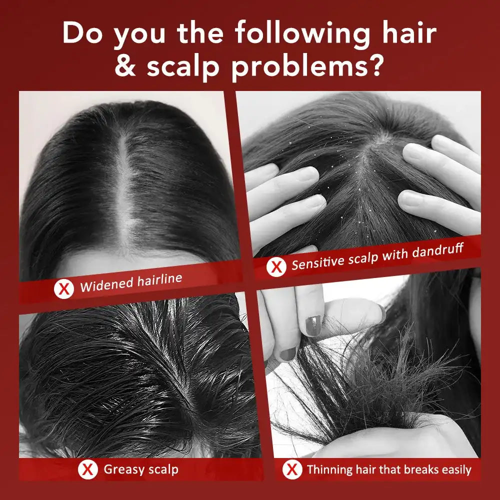 Electric Scalp Massage Brush – Red Light Therapy Hair Growth Comb - Loc vibes only